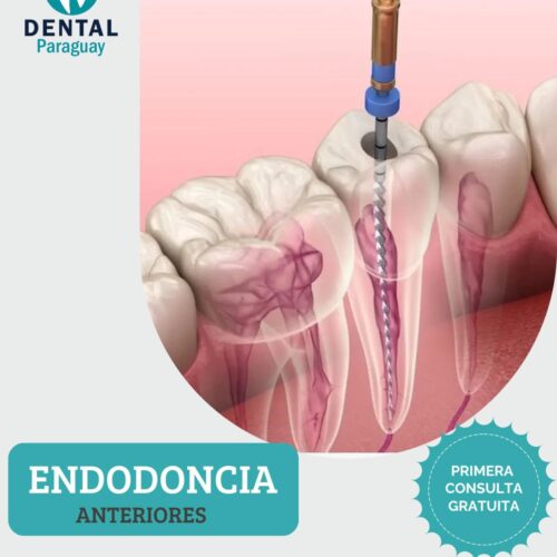 ENDODONCIA EN DIENTES ANTERIORES