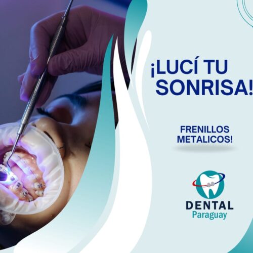 FRENILLOS METALICOS