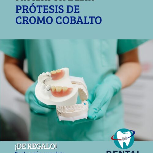 PROTESIS COMPLETA DE CROMO COBALTO